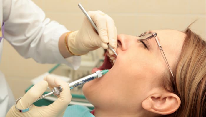 هل يؤثر بنج الأسنان على الدورة الشهرية