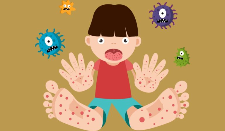علاج فيروس اليد والقدم والفم للاطفال ، متى ينتهي فيروس الفم واليد والقدم؟ متى يصبح فيروس الفم واليد والقدم غير معدي؟