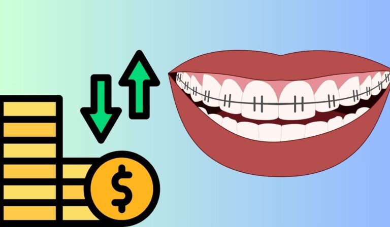 سعر تقويم الأسنان الفك العلوي فقط ، أرخص سعر تقويم الأسنان، سعر تقويم الأسنان في المستشفيات الحكومية، أنواع تقويم الأسنان الفك العلوي.